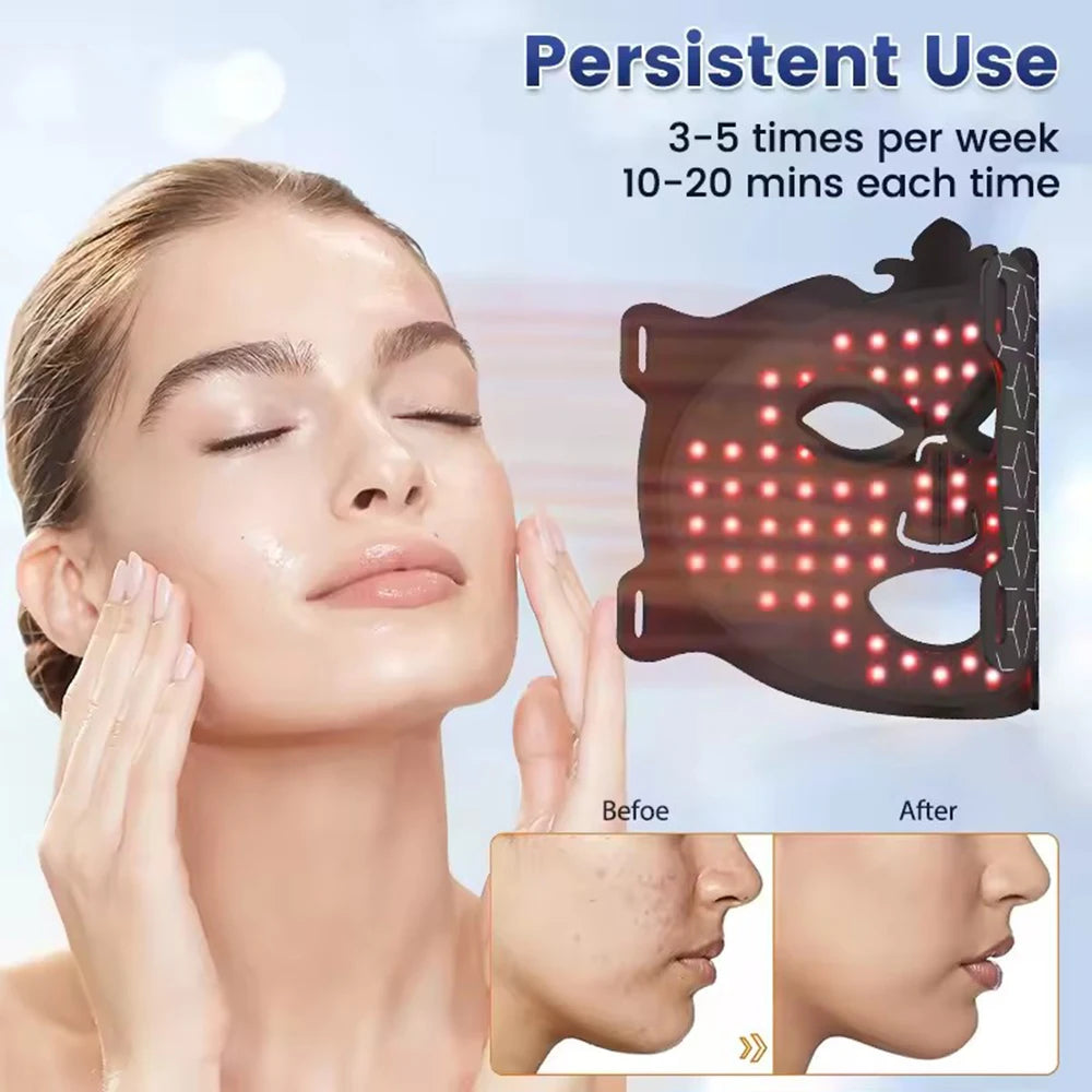 Radiant Skin LED Face Mask™